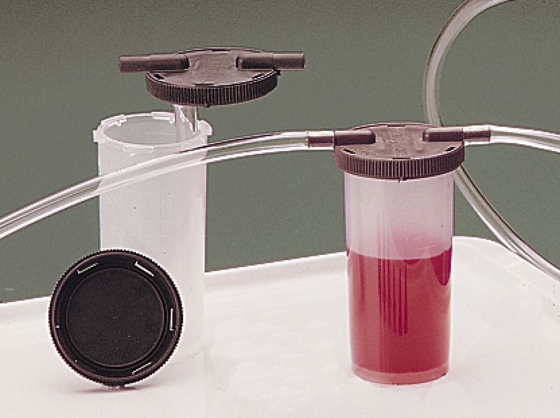 Sampling set for VacuMan (hose, sample container)